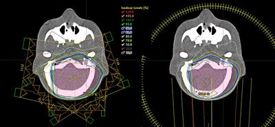 Experimental Validation of an Analytical Program and a Monte Carlo Simulation for the Computation of the Far Out-of-Field Dose in External Beam Photon Therapy Applied to Pediatric Patients